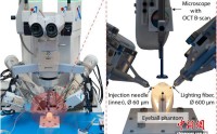 中国团队成功研发自主显微眼科手术机器人系统 已验证临床可行性,中国团队成功研发自主显微眼科手术机器人系统 已验证临床可行性