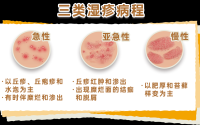 湿疹可能是“干”出来的 冬季皮肤瘙痒需警惕,湿疹可能是“干”出来的 冬季皮肤瘙痒需警惕
